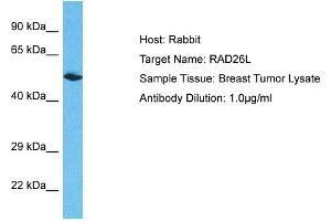Host: Rabbit Target Name: RAD26L Sample Type: Breast Tumor lysates Antibody Dilution: 1. (ERCC6L2 抗体  (N-Term))