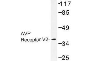Image no. 1 for anti-Arginine Vasopressin Receptor 2 (AVPR2) antibody (ABIN317870) (AVPR2 抗体)