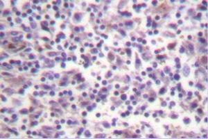 Image no. 1 for anti-B-Raf proto-oncogene, serine/threonine kinase (BRAF) antibody (ABIN271999) (BRAF 抗体)