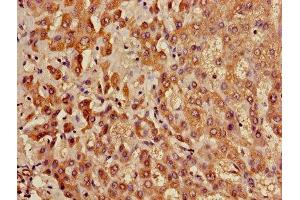 Immunohistochemistry of paraffin-embedded human liver tissue using ABIN7158499 at dilution of 1:100 (ACADL 抗体  (AA 30-260))