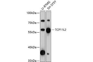 Western blot analysis of extracts of various cell lines, using TCP11L2 antibody (ABIN6133204, ABIN6148958, ABIN6148959 and ABIN6217166) at 1:3000 dilution. (TCP11L2 抗体  (AA 1-340))