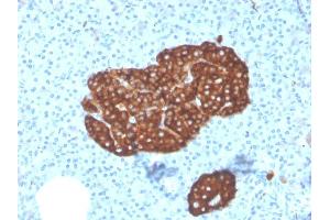 Immunohistochemistry (IHC) image for anti-Mismatch Repair Protein 2 (MSH2) (AA 224-313) antibody (ABIN6940677)