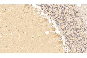 Detection of TF in Human Cerebellum Tissue using Monoclonal Antibody to Tissue Factor (TF)