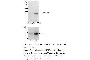 Western Blotting (WB) image for anti-Tumor Protein P53 (TP53) (pSer315) antibody (ABIN3201006) (p53 抗体  (pSer315))