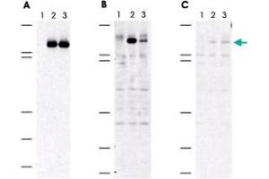 Immunoblot of MAP3K5 (phospho S83) polyclonal antibody  shows specificity for phosphorylated human MAP3K5. (ASK1 抗体  (pSer83))