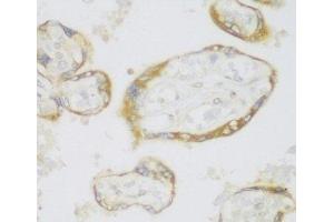Immunohistochemistry (Paraffin-embedded Sections) (IHC (p)) image for anti-ER Lipid Raft Associated 1 (ERLIN1) antibody (ABIN7258170)