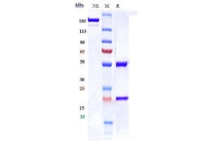 Anti-CDCP1 / CD318 Reference Antibody (38 E11) on SDS-PAGE under reducing (R) condition.