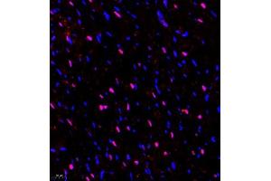Immunofluorescence (Paraffin-embedded Sections) (IF (p)) image for anti-Zinc Finger Protein 106 Homolog (ZFP106) antibody (ABIN7076260)
