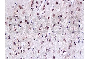 Formalin-fixed and paraffin embedded rat brain tissue labled with Anti-LAMR1 Polyclonal Antibody, unconjugated (ABIN729583)  at 1: 200, followed by incubation with conjugated secondary antibody and DAB staining (RPSA/Laminin Receptor 抗体  (AA 101-200))