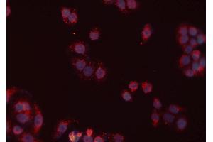 ABIN6277430 staining Hela cells by IF/ICC. (RAD52 抗体  (Internal Region))