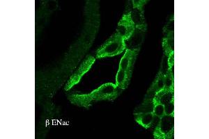 Immunohistochemistry analysis using Rabbit Anti-ENaC Polyclonal Antibody . (SCNN1A 抗体  (AA 617-638) (HRP))