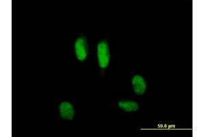 Immunofluorescence of purified MaxPab antibody to USP39 on HeLa cell. (USP39 抗体  (AA 1-565))