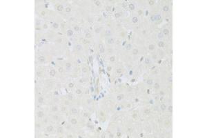 Immunohistochemistry of paraffin-embedded rat liver using KAT2A antibody (ABIN5971244) at dilution of 1/100 (40x lens). (KAT2A 抗体)