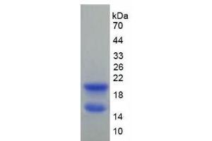 SDS-PAGE analysis of Rat Connexin 40 Protein. (Cx40/GJA5 蛋白)