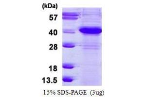 Excision Repair Cross Complementing Polypeptide-1 (ERCC1) (AA 1-273) protein (His tag)