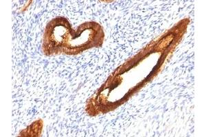Immunohistochemistry (Formalin-fixed Paraffin-embedded Sections) (IHC (fp)) image for anti-Mucin 1 (MUC1) antibody (ABIN3025281)