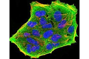 Immunofluorescence (IF) image for anti-Glutamine--Fructose-6-Phosphate Transaminase 1 (GFPT1) (AA 536-681) antibody (ABIN5542686)