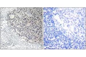 Immunohistochemistry (IHC) image for anti-Collagen, Type IX, alpha 3 (COL9A3) (AA 321-370) antibody (ABIN1534350)