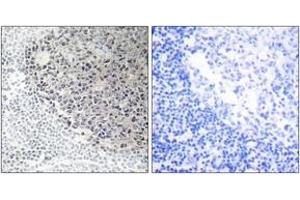 Immunohistochemistry analysis of paraffin-embedded human tonsil tissue, using Collagen IX alpha3 Antibody. (COL9A3 抗体  (AA 321-370))