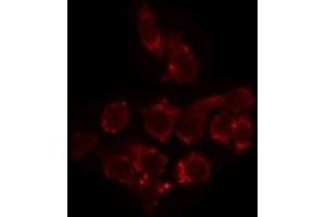 Immunofluorescence (fixed cells) (IF/ICC) image for anti-Solute Carrier Family 25 (Mitochondrial Carrier, Oxoglutarate Carrier), Member 11 (SLC25A11) (Internal Region) antibody (ABIN6259189)