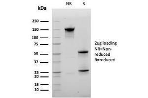 SDS-PAGE Analysis Purified CD20 Mouse Monoclonal Antibody (MS4A1/3410). (CD20 抗体  (AA 213-297))