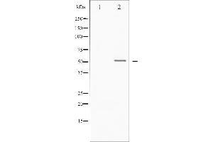 Western blot analysis of Vitamin D Receptor phosphorylation expression in heatshock treated HT29 whole cell lysates,The lane on the left is treated with the antigen-specific peptide.