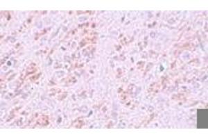 Immunohistochemistry (IHC) image for anti-VENT Homeobox (VENTX) (Middle Region) antibody (ABIN1031159) (VENTX 抗体  (Middle Region))