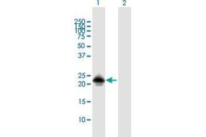 Western Blot analysis of MSRB3 expression in transfected 293T cell line by MSRB3 MaxPab polyclonal antibody. (MSRB3 抗体  (AA 1-185))