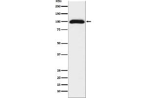 Western blot analysis of CD276 expression in 293T cell lysate.