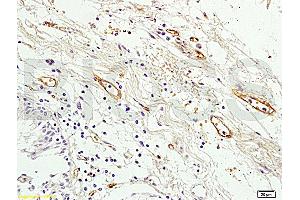 Formalin-fixed and paraffin embedded human colon tissue labeled with Anti Prominin2 Polyclonal Antibody, Unconjugated (ABIN715151) at 1:200 followed by conjugation to the secondary antibody and DAB staining