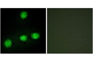 Immunofluorescence analysis of HuvEc cells, using CLK1 Antibody. (CLK1 抗体  (AA 101-150))