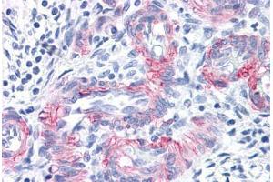 Vessels in Human Uterus: Formalin-Fixed, Paraffin-Embedded (FFPE) (MCAM 抗体)