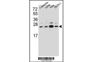 Western blot analysis in human placenta tissue and Jurkat,Hela,ZR-75-1 cell line lysates (35ug/lane). (SSR2 抗体  (C-Term))