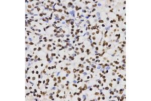 Immunohistochemistry (IHC) image for anti-Histone 3 (H3) (H3K4me) antibody (ABIN3023251)