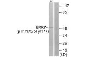 Western blot analysis of extracts from Jurkat cells, using ERK8 (Phospho-Thr175+Tyr177) Antibody. (MAPK15 抗体  (pThr175))