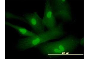 Immunofluorescence of purified MaxPab antibody to SPA17 on Hs 181. (SPA17 抗体  (AA 1-151))