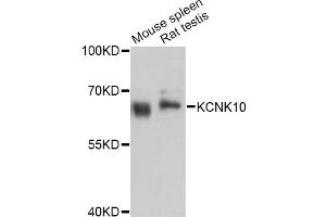 Western blot analysis of extracts of various cell lines, using KCNK10 Antibody (ABIN4904134) at 1:3000 dilution. (KCNK10 抗体)