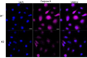 Immunocytochemical staining of HeLa cells using Caspase 9 antibody (ABIN7797910), 1:1,000), Top panel: wild-type (WT), Bottom panal: Caspase 9 shRNA knockdown (KD). (Recombinant Caspase 9 抗体)