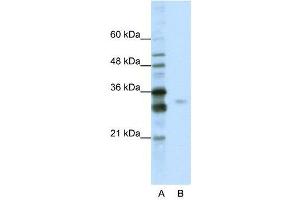 WB Suggested Anti-SFRS1  Antibody Titration: 0. (SRSF1 抗体  (C-Term))