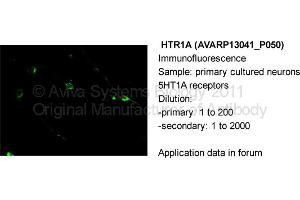 Primary cultured neurons 5HT1A Receptors Dilution:  Primary: 1:200  Secondary: 1:2000 (Serotonin Receptor 1A 抗体  (N-Term))