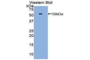 Western blot analysis of the recombinant protein. (Netrin 1 抗体  (AA 313-565))