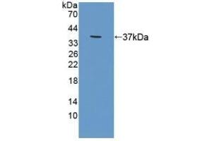 Detection of Recombinant RDX, Human using Polyclonal Antibody to Radixin (RDX) (Radixin 抗体  (AA 5-295))