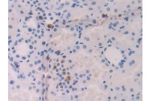 Immunohistochemistry (IHC) image for anti-Interleukin 18 (IL18) (AA 37-193) antibody (ABIN7429628)