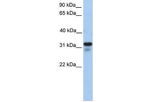 HS3ST6 antibody used at 1 ug/ml to detect target protein. (Heparan Sulfate (Glucosamine) 3-O-Sulfotransferase 6 (HS3ST6) 抗体)
