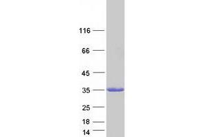 Western Blotting (WB) image for RAB27A, Member RAS Oncogene Family (RAB27A) (Transcript Variant 1) protein (Myc-DYKDDDDK Tag) (ABIN2730309)