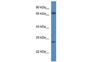 Western Blot showing F11 antibody used at a concentration of 1 ug/ml against Hela Cell Lysate (Factor XI 抗体  (C-Term))