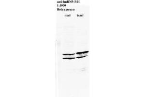 Image no. 2 for anti-Heterogeneous Nuclear Ribonucleoprotein L (HNRNPL) antibody (ABIN108560) (HNRNPL 抗体)