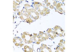 Immunohistochemistry of paraffin-embedded human stomach using COQ7 antibody (ABIN5975182) at dilution of 1/100 (40x lens). (Coq7 抗体)