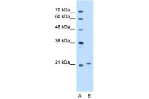 WB Suggested Anti-TCAP Antibody Titration:  5. (TCAP 抗体  (Middle Region))