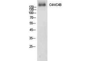 Western Blotting (WB) image for anti-Complement C4A/C4B (Internal Region) antibody (ABIN3178888) (Complement C4A/C4B (Internal Region) 抗体)